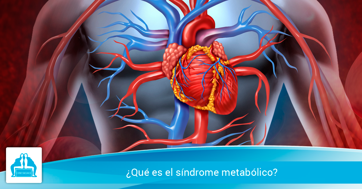 ¿Qué es el síndrome metabólico?